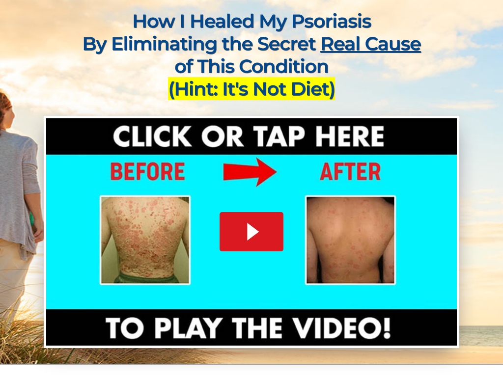Psoriasis Revolution Review