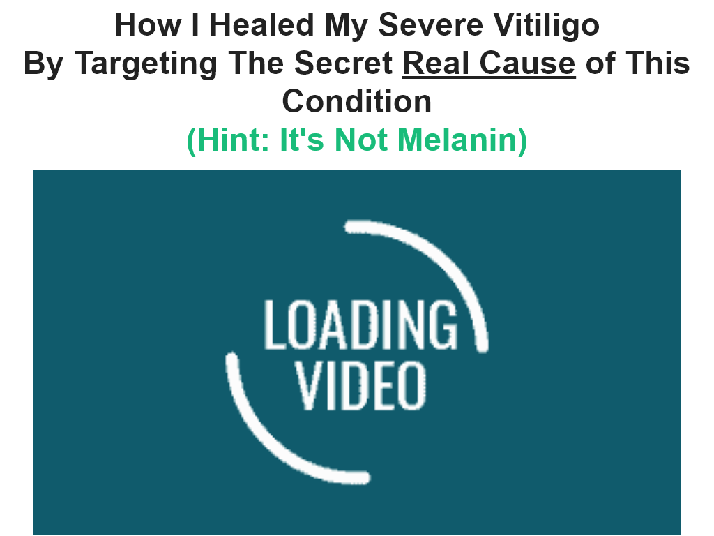 Vitiligo Miracle Review